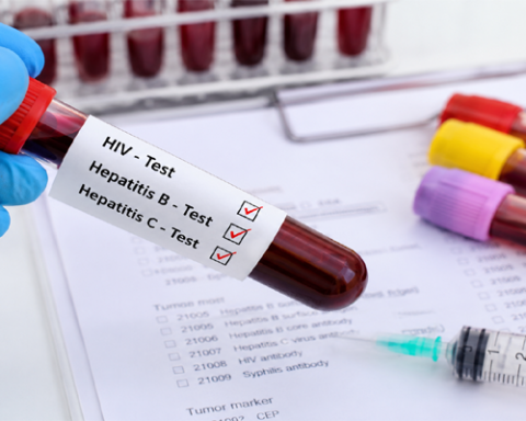Pakistan makes HIV, Hepatitis tests mandatory before surgeries