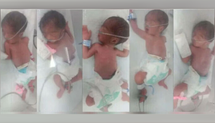Joyful Surprise: Couple welcome five newborns