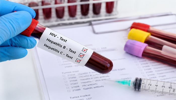 Pakistan makes HIV, Hepatitis tests mandatory before surgeries